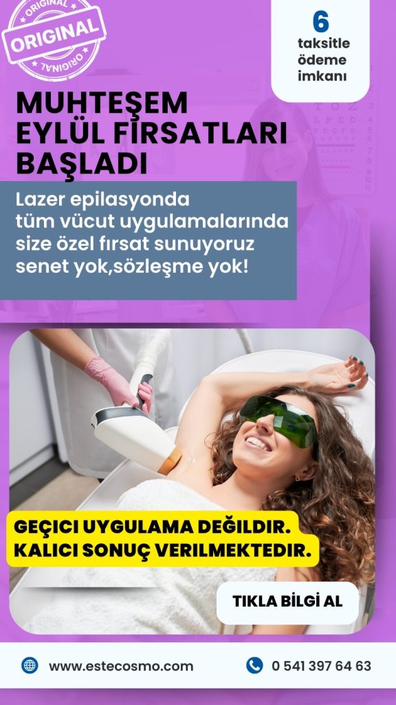 lazer epilasyon-kartal